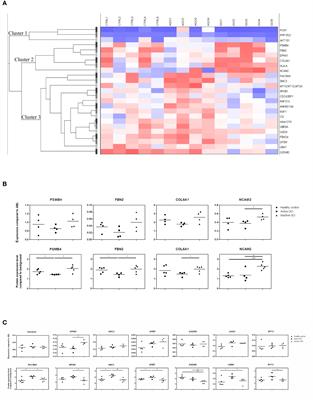 Integrative Analysis of Proteomics and DNA Methylation in Orbital Fibroblasts From Graves’ Ophthalmopathy